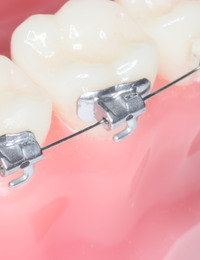 Dr. Tina Manh Orthodontist